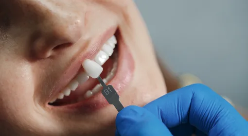 All-on-6 Implants