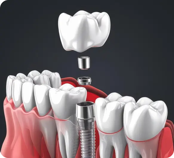 Gum Treatment