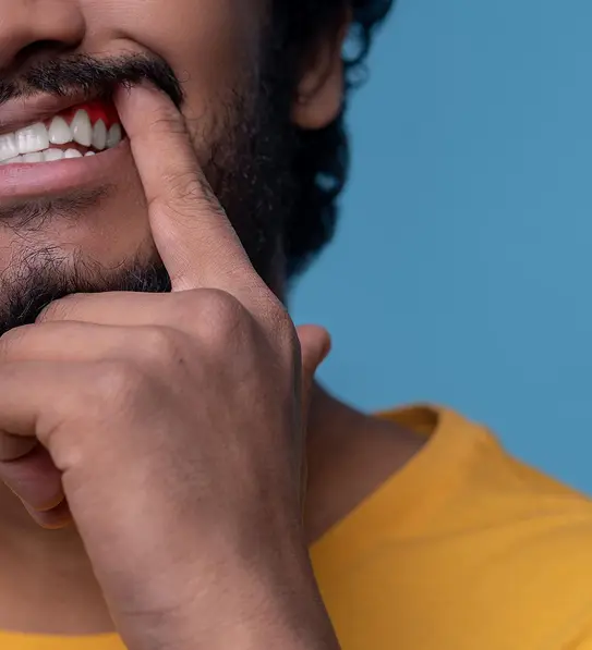 Gum Treatment